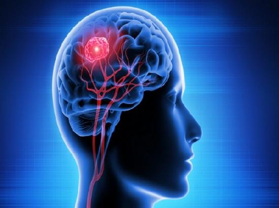 Study reveals novel therapeutic target for traumatic brain injury
