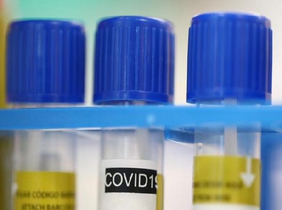 27,55,714 COVID-19 tests done so far: ICMR