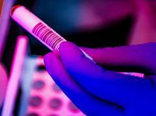 Punjab govt caps price of Rapid Antigen Test