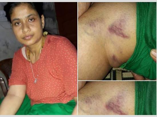 Haryana  IAS Rani Nagar and her sister attacked, sister injured