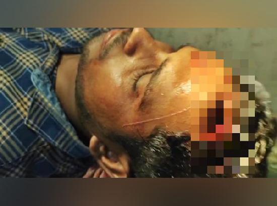 ANI stringer Bunty Mukherjee severely injured in TMC-BJP clashes in West Bengal