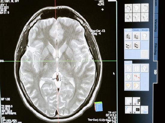 How the brain controls symptoms of sickness: Study